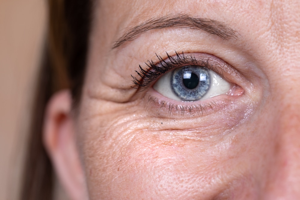 How A Blepharoplasty Can Help You Turn Back The Clock