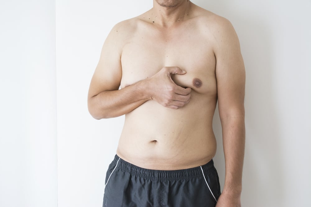Aging and Gynecomastia: How Are They Related?